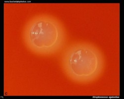 Streptococcus agalactiae colonies on blood agar